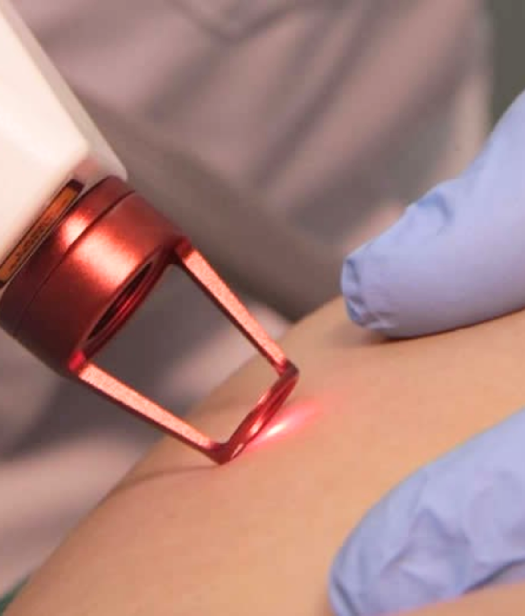Angiologista e Cirurgiã Vascular em Conselheiro Lafaiete e em Congonhas | Especialista no Tratamento de Varizes e no Tratamento de Lipedema