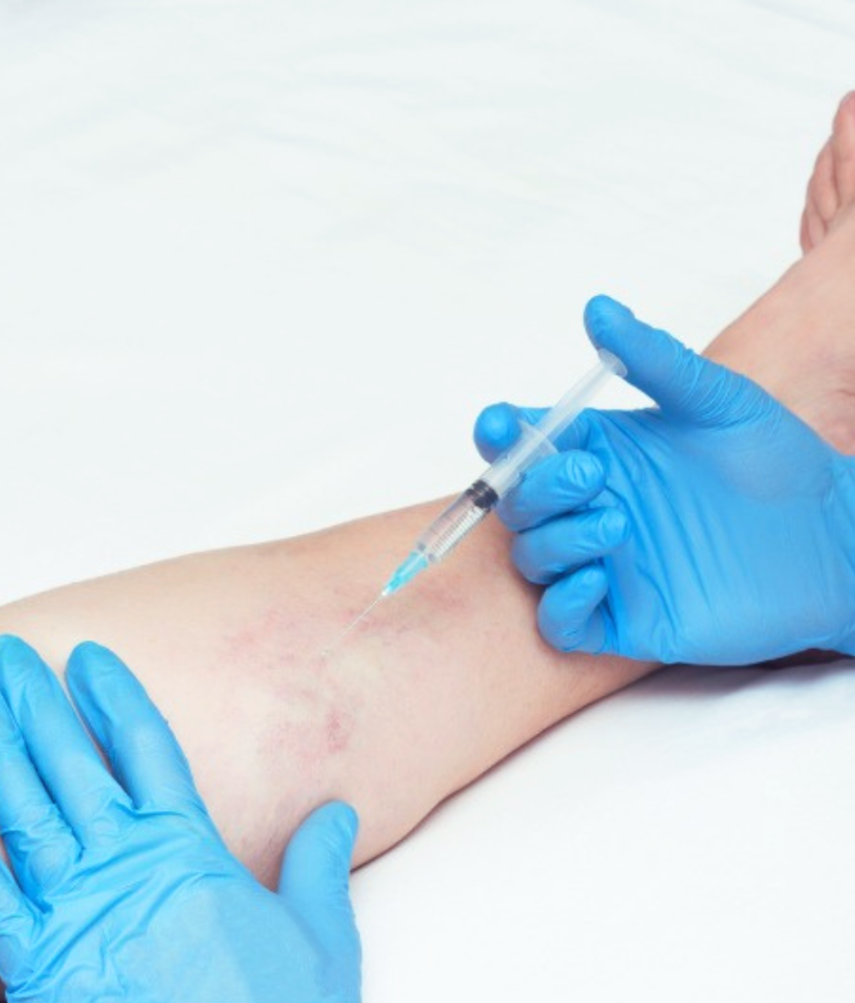 Angiologista e Cirurgiã Vascular em Conselheiro Lafaiete e em Congonhas | Especialista no Tratamento de Varizes e no Tratamento de Lipedema