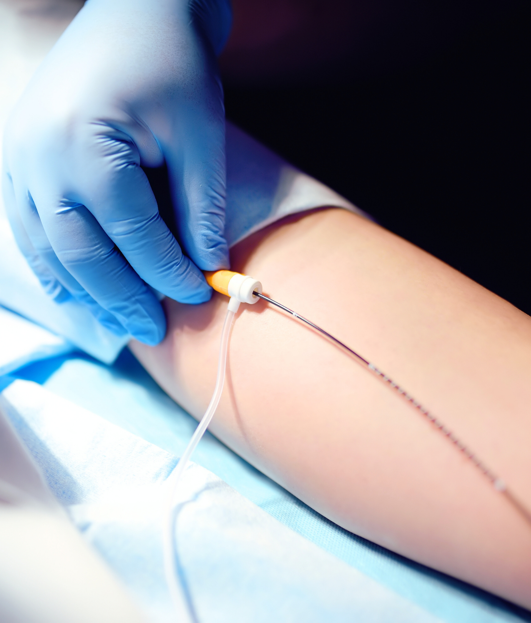Angiologista e Cirurgiã Vascular em Conselheiro Lafaiete e em Congonhas | Especialista no Tratamento de Varizes e no Tratamento de Lipedema