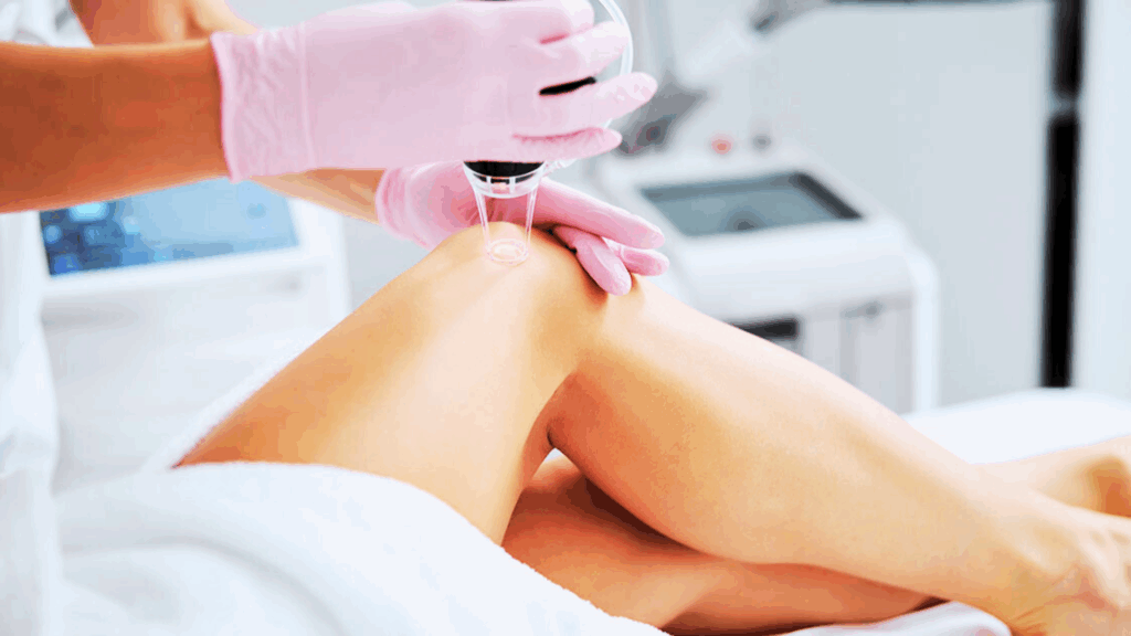 Angiologista e Cirurgiã Vascular em Conselheiro Lafaiete e em Congonhas | Especialista no Tratamento de Varizes e no Tratamento de Lipedema