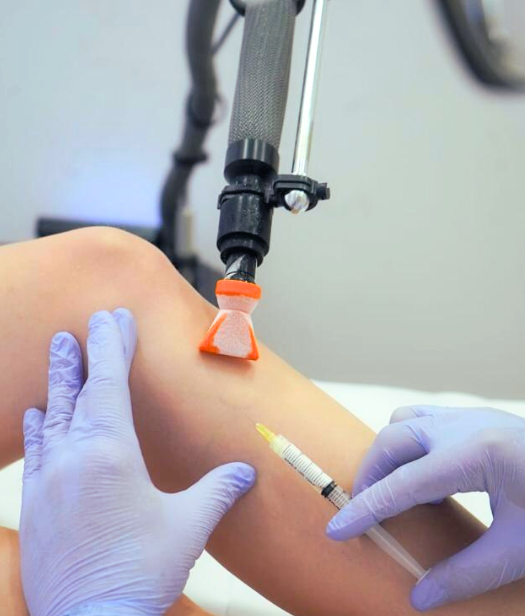 Angiologista e Cirurgiã Vascular em Conselheiro Lafaiete e em Congonhas | Especialista no Tratamento de Varizes e no Tratamento de Lipedema