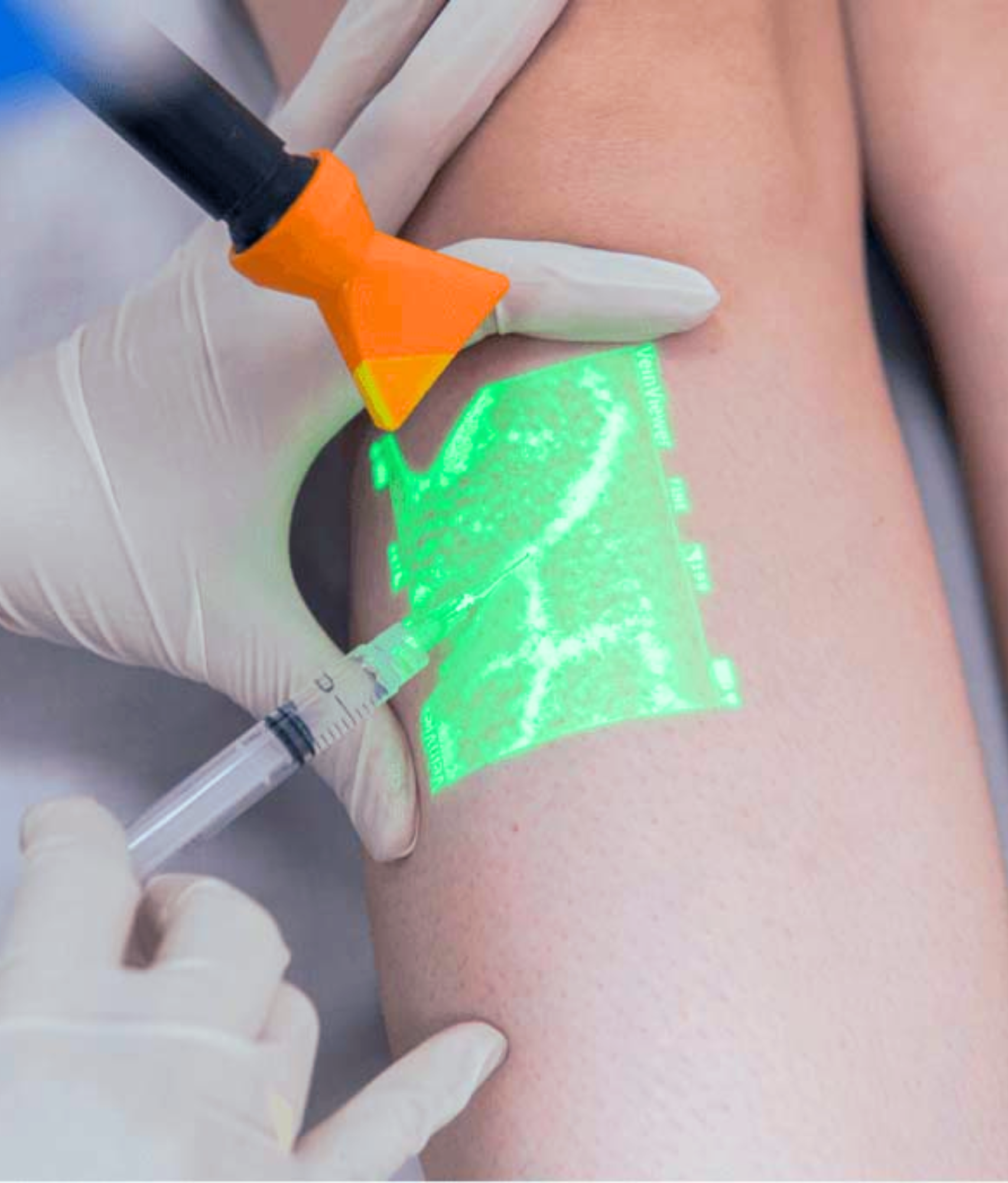 Angiologista e Cirurgiã Vascular em Conselheiro Lafaiete e em Congonhas | Especialista no Tratamento de Varizes e no Tratamento de Lipedema